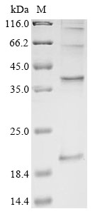 Influenza A virus Matrix protein 2 Protein