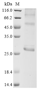 Human AQP5 Protein