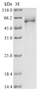 Human UGT2B17 Protein