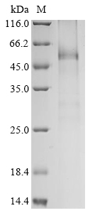 Human UGT1A7 Protein