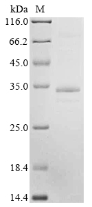 Human PARL Protein