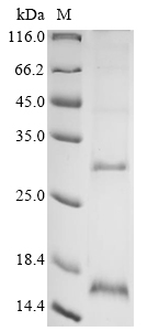 Influenza A virus Matrix protein 2 Protein