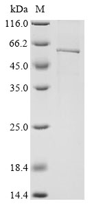 Human FAAH2 Protein