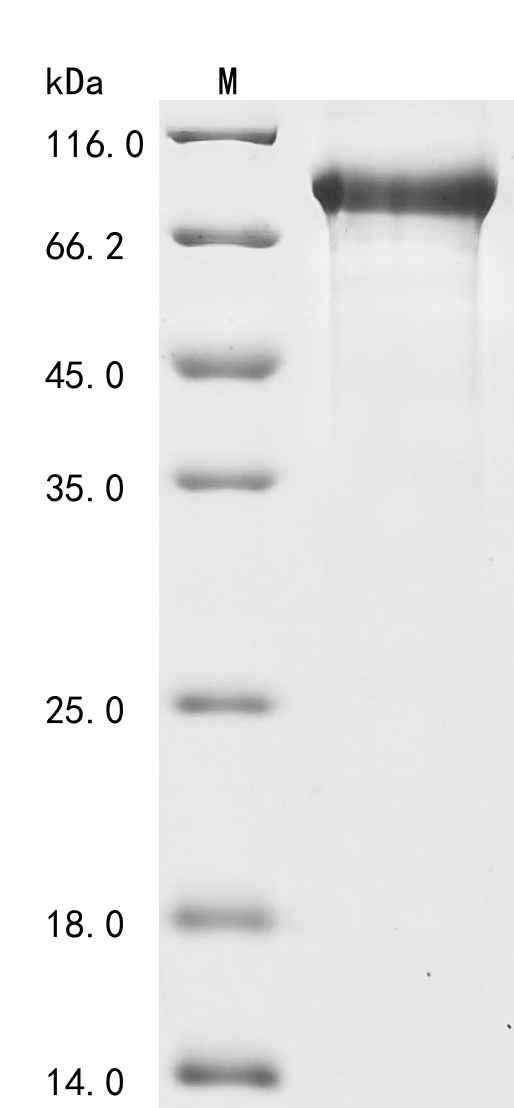 Mouse C1s1 Protein
