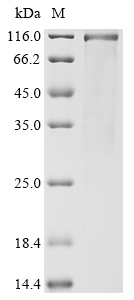 Human HOXA3 Protein