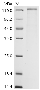 Severe acute respiratory syndrome coronavirus 2 Spike glycoprotein Protein