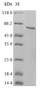 Human WARS1 Protein