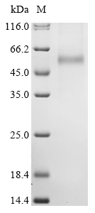 Hantaan virus Envelopment polyprotein Protein
