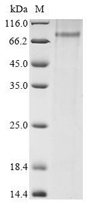 Rat Masp2 Protein
