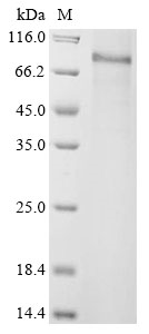 Human ADAM33 Protein