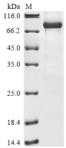 Human RNF168 Protein