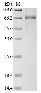 Human WRN Protein