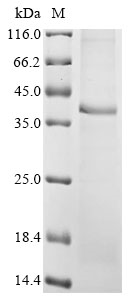 Mouse Ccn6 Protein
