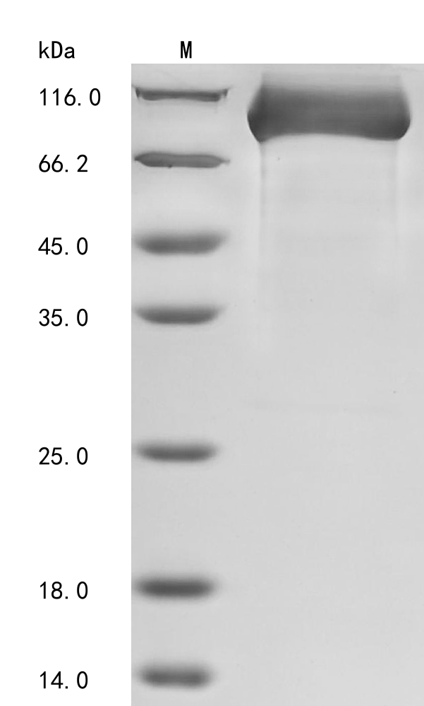 Human DPP4 Protein