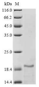 Avian infectious bronchitis virus Non-structural protein 5a Protein