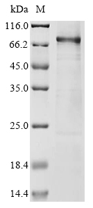 Human UBTF Protein