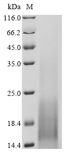 Puccinia triticina Uncharacterized Protein