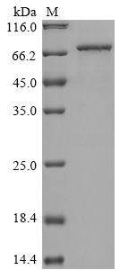 Human MAT2A Protein
