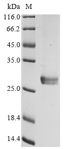 Human RPP25 Protein