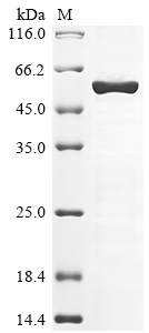 Human CBX8 Protein