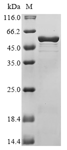 Yersinia pestis Virulence-associated V antigen Protein