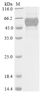 UGT88A1 Protein