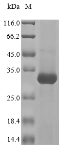 Human Ceruloplasmin Protein