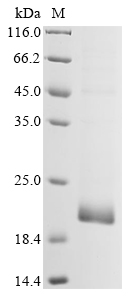 Human coronavirus 229E Membrane Protein