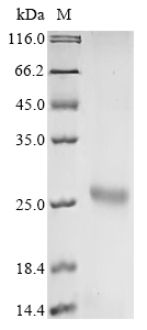 Avian infectious bronchitis virus Spike glycoprotein Protein