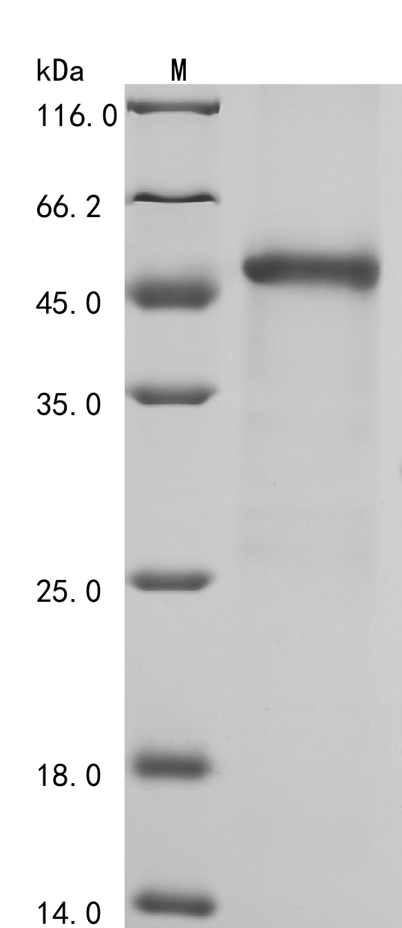 Human F13B Protein