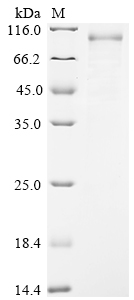 Human WRN Protein