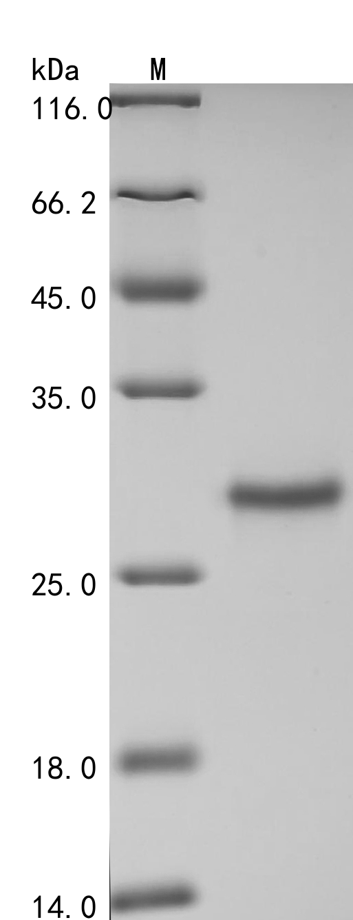 Human GSTM3 Protein