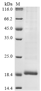 Avian infectious bronchitis virus Non-structural protein 5a Protein