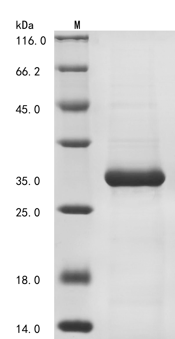 Human FILIP1L Protein