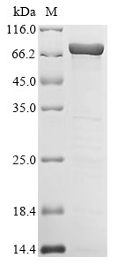 Human HIST1H1D Protein
