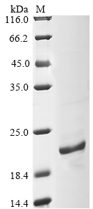 Rat Ddt Protein