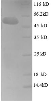 Human FGF5 Protein