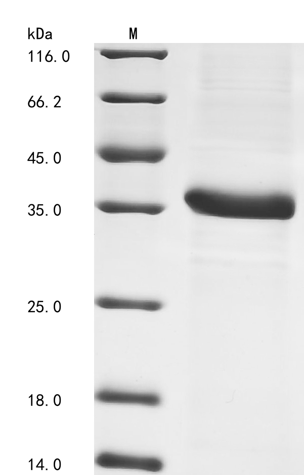 Mouse Complement C4-B Protein