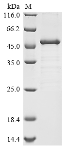 Human NOTCH1 Protein