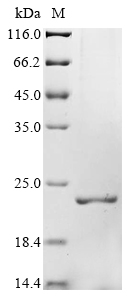 Human SRXN1 Protein