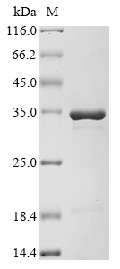 Mouse Tfam Protein