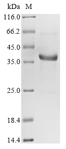 Human NF1 Protein