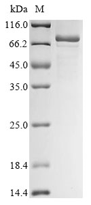 Human YTHDF2 Protein
