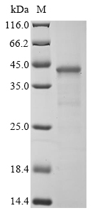 Human PRB1 Protein