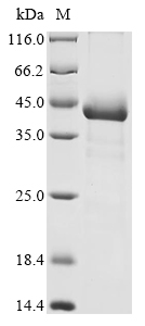 Human PDHB Protein