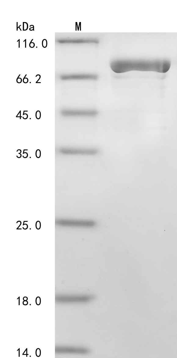 Porcine FTCD Protein (Biotin)