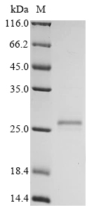 Human GAGE7 Protein
