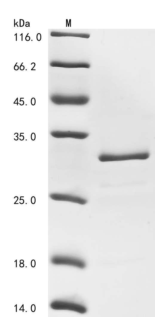 Rat Carbonic anhydrase 2 Protein
