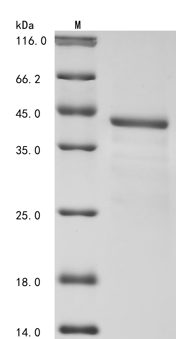 Human BTD Protein