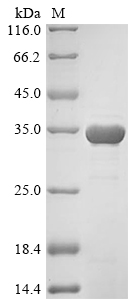 Human 14-3-3 protein sigma Protein